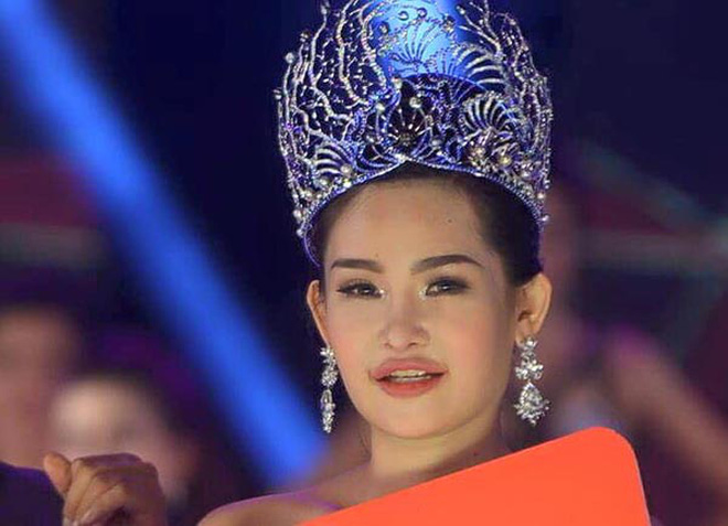 Rõ ràng là môi tều thế kia mà sao Việt nào cũng chối đây đẩy khi dính nghi vấn đụng chạm dao kéo Rõ ràng là môi tều thế kia mà sao Việt nào cũng chối đây đẩy khi dính nghi vấn đụng chạm dao kéo