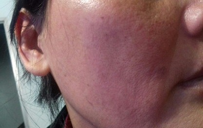 Sơn La: Bất chấp con trai 10 tuổi đứng trước mặt, chồng vẫn đánh đập và cắt trọc đầu vợ