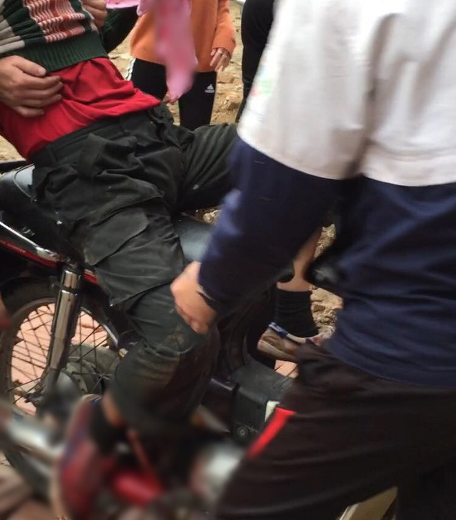 Người đàn ông bị nổ nát bàn tay khi nhặt vỏ đạn sau vụ nổ kinh hoàng ở Bắc Ninh Người đàn ông bị nổ nát bàn tay khi nhặt vỏ đạn sau vụ nổ kinh hoàng ở Bắc Ninh