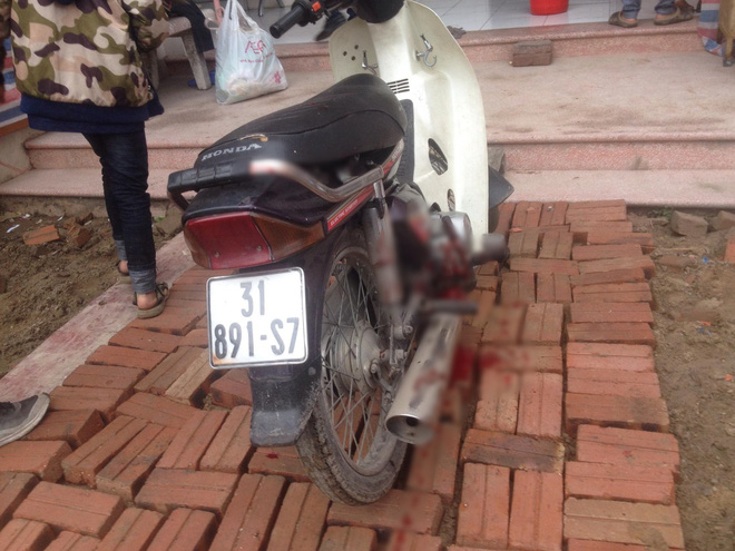 Người đàn ông bị nổ nát bàn tay khi nhặt vỏ đạn sau vụ nổ kinh hoàng ở Bắc Ninh