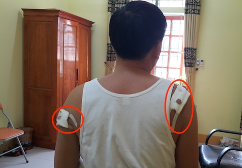 Trưởng công an nã bốn phát đạn vào chủ tịch xã bị khởi tố