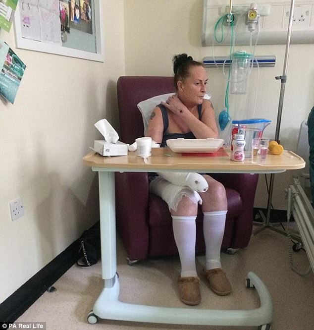 Suýt chết vì 1 vết xước ở tay: Cảnh báo căn bệnh gây tử vong hơn 3 loại ung thư cộng lại