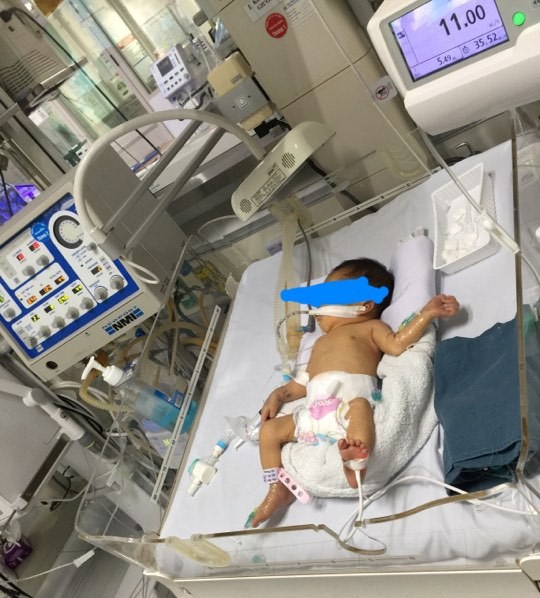 Bé gái 32 tuần tuổi bị mẹ phá thai để chối bỏ được nhóm thiện nguyện khi đi nhặt xác thai nhi cứu sống