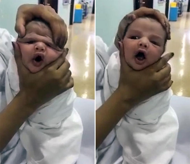 Y tá vừa cười vừa bóp mặt trẻ sơ sinh đến biến dạng