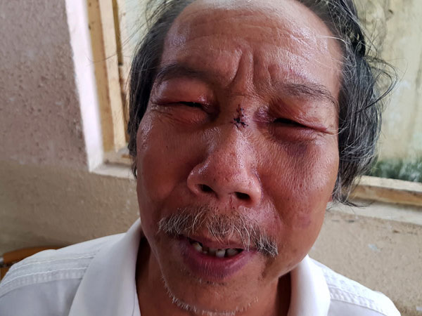 Bảo vệ đánh nhà thơ 68 tuổi ngất xỉu từng đi tù vì buôn bán ma túy