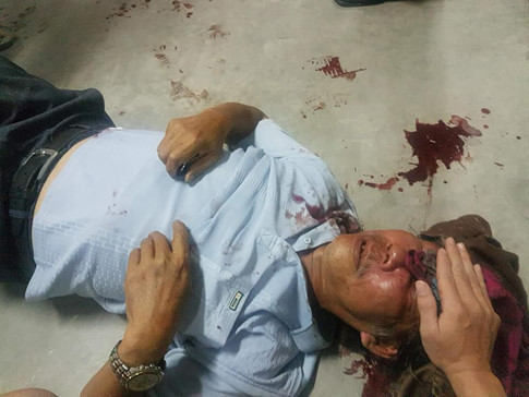 Lời khai của bảo vệ chung cư đánh cụ ông 68 tuổi