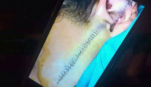 Nữ sinh lớp 11 bị rạch mặt trong cuộc cãi vã ở chợ