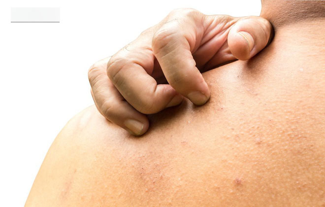 Không thể coi thường: 8 dấu hiệu trên da của bệnh đái tháo đường