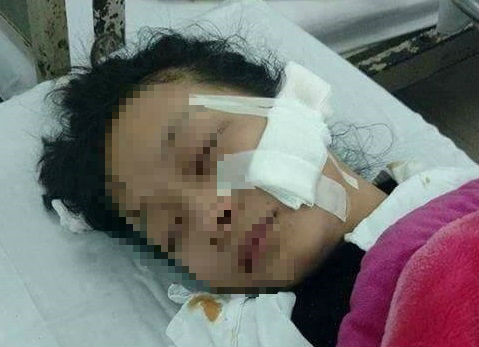 Khởi tố vụ nữ sinh lớp 11 bị rạch mặt ở chợ