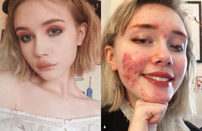 Mệt mỏi vì sống ảo, hot girl 17 tuổi lộ mặt thật khiến dân tình sốc nặng