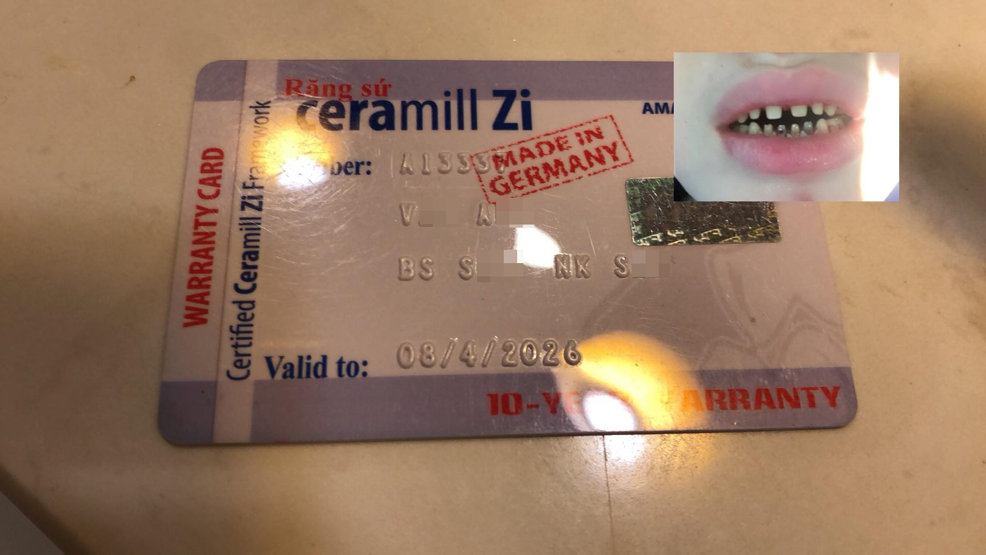 Bọc răng, uốn tóc, cắt mí - Những ca làm đẹp thông thường nhưng đã khiến các nạn nhân tiền mất tật mang