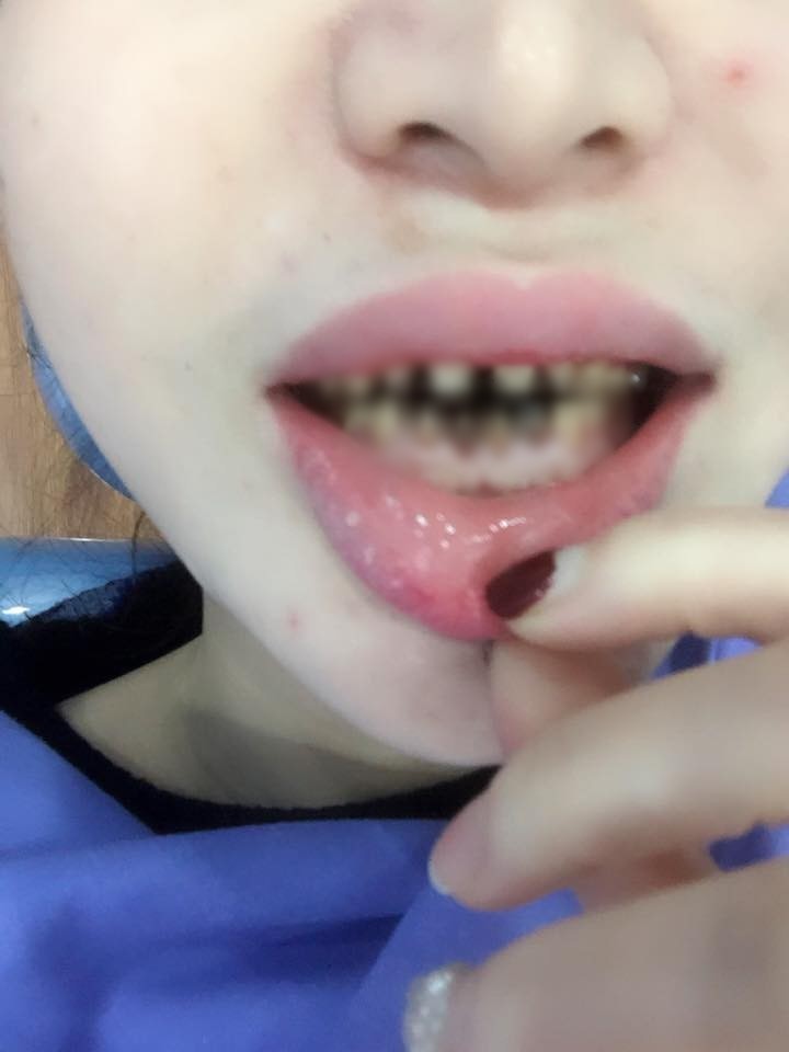 Bọc răng, uốn tóc, cắt mí - Những ca làm đẹp thông thường nhưng đã khiến các nạn nhân tiền mất tật mang