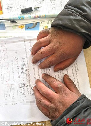 Cậu bé TQ bị đóng băng toàn bộ tóc vì trời giá rét