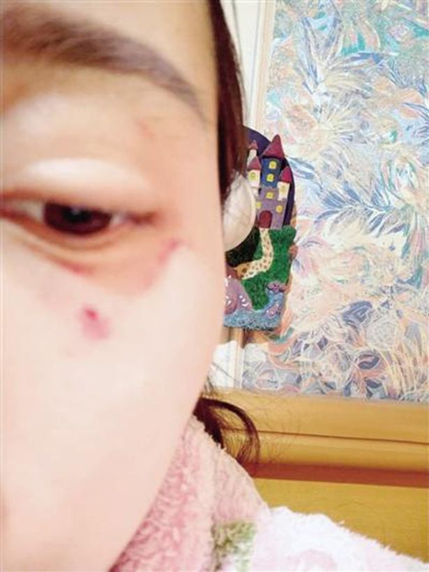 Chủ shop đi 800km để đánh khách hàng phàn nàn dịch vụ