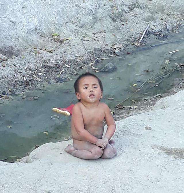 Câu chuyện bất ngờ phía sau clip bé 6 tuổi nặng 10kg không mặc quần áo ngồi lề đường