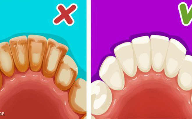 Ghi nhớ 6 mẹo đơn giản để có một hàm răng trắng như sứ Ghi nhớ 6 mẹo đơn giản để có một hàm răng trắng như sứ