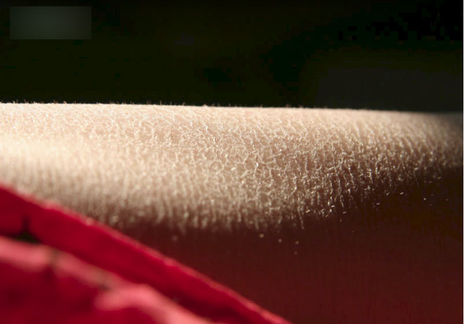 Mùa đông ngày nào cũng tắm tốt hay không tốt? Đây là câu trả lời ai cũng cần biết