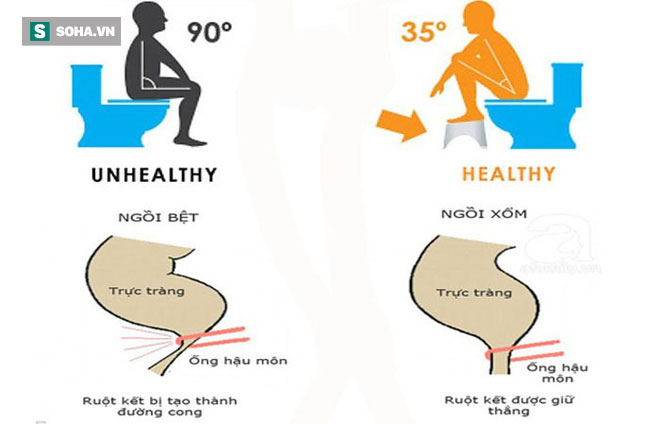 Đây mới là tư thế ngồi khi đi vệ sinh tốt nhất cho sức khoẻ