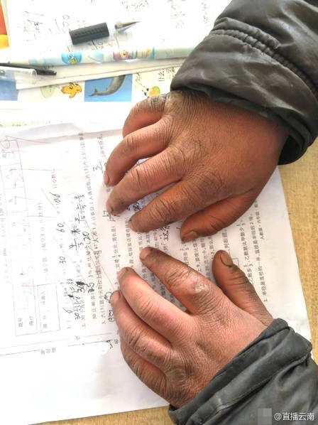 Tâm sự của cha cậu bé tóc đông đá đi bộ 5 km tới trường dưới thời tiết -9 độ C: Tôi chỉ mong con tiếp tục học hành