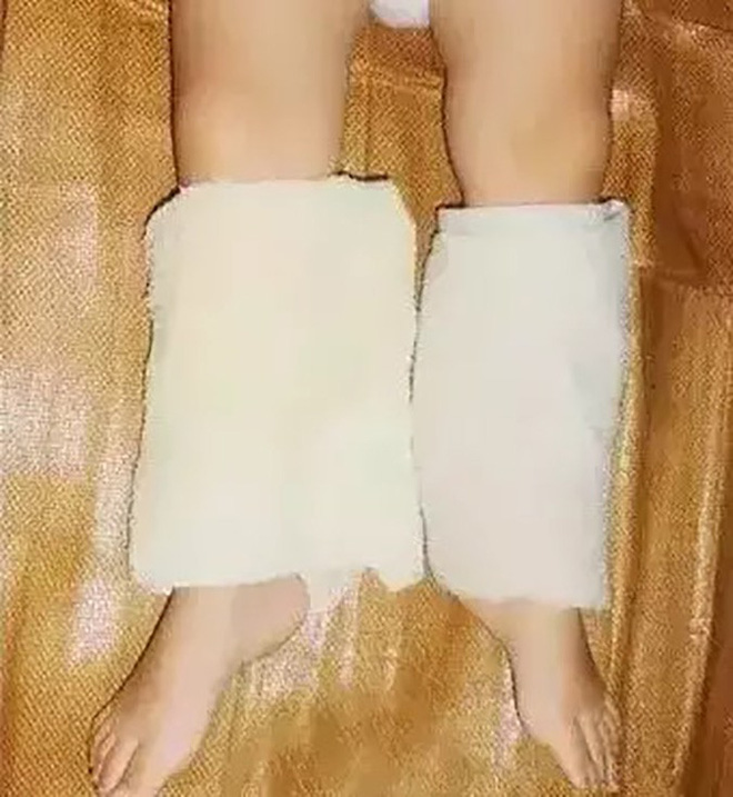 Trẻ sốt nên chườm nóng hay lạnh: Bố mẹ nào cũng phải nhớ để tuyệt đối không phạm sai lầm Trẻ sốt nên chườm nóng hay lạnh: Bố mẹ nào cũng phải nhớ để tuyệt đối không phạm sai lầm