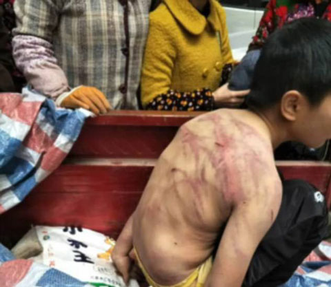 Bị bố mẹ đánh, bé trai cởi trần ngủ suốt đêm ngoài trời âm 2 độ