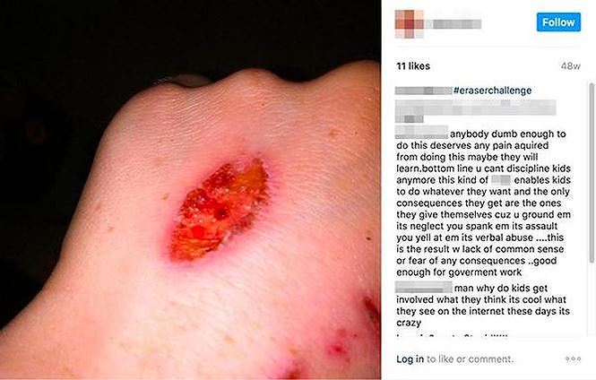 Khi người trẻ thích rạch tay, xăm kín mặt hủy hoại bản thân