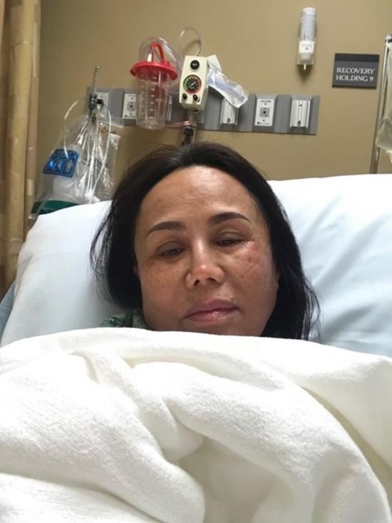 Gặp tai nạn nghiêm trọng khi biểu diễn, danh ca Thanh Tuyền tiều tụy trên giường bệnh