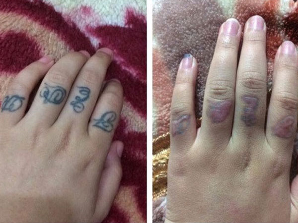 Cô gái xăm hình từ lớp 8 và vết sẹo đi theo cả cuộc đời