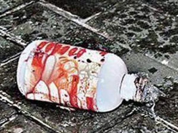 Nghi bị phản bội, người đàn bà tạt axit chồng