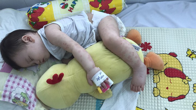 Mẹ tưởng con chỉ bị viêm phổi nhưng cuối cùng lại mắc bệnh lạ nguy hiểm