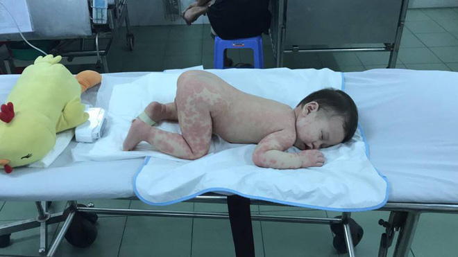 Mẹ tưởng con chỉ bị viêm phổi nhưng cuối cùng lại mắc bệnh lạ nguy hiểm Mẹ tưởng con chỉ bị viêm phổi nhưng cuối cùng lại mắc bệnh lạ nguy hiểm