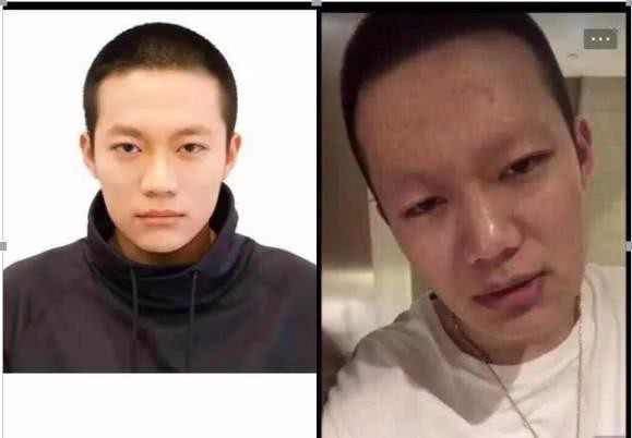 Nhân tình trẻ của Lý Tiểu Lộ bị trầm cảm, ngày nào cũng khóc lóc và muốn tự tử