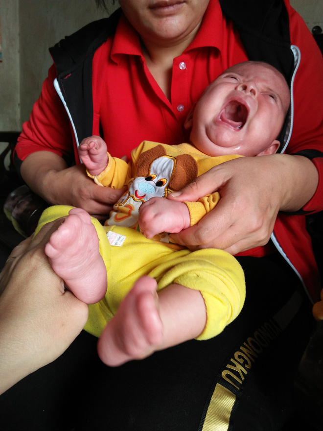 Con mới sinh đã mắc căn bệnh hiếm gặp ngặt nghèo, bố mẹ suốt ngày thay nhau bế vì con nằm xuống là tắt thở