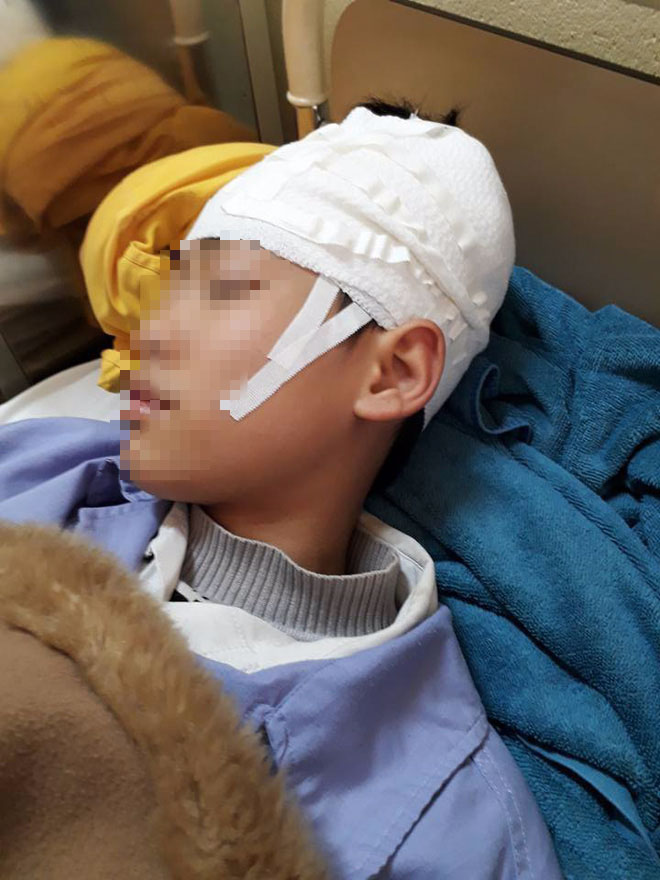 Quảng Ninh: Nam sinh lớp 9 nhập viện, nghi bị thầy giáo tát khiến tụ máu ở đầu