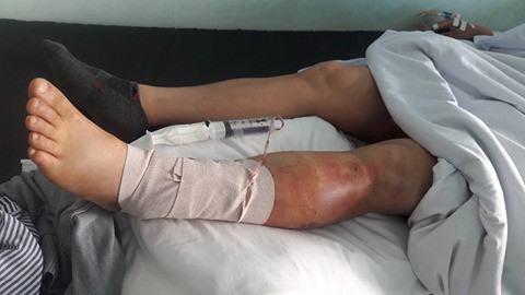 Hải Phòng: 5 thanh niên truy sát một người đàn ông ngay giữa ban ngày