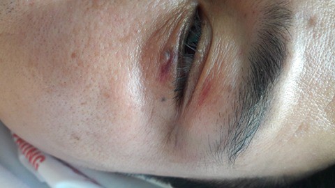 Hải Phòng: 5 thanh niên truy sát một người đàn ông ngay giữa ban ngày