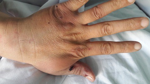 Hải Phòng: 5 thanh niên truy sát một người đàn ông ngay giữa ban ngày