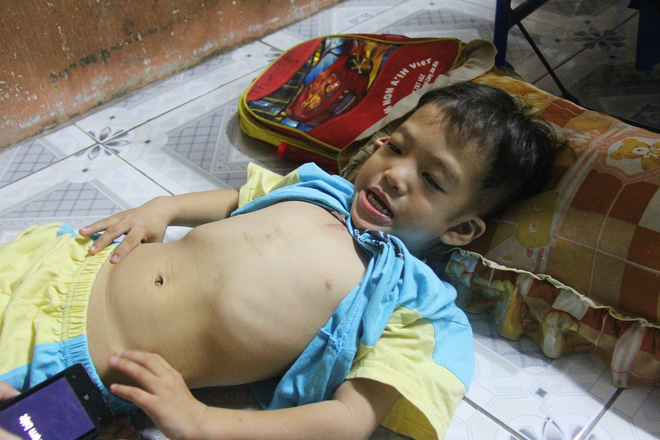 Chồng bỏ đi, người mẹ trẻ nuốt nước mắt nuôi hai con nhỏ dại, bệnh tật