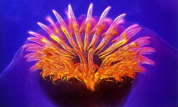 Người đàn ông mắc sán dây 1,7 m vì thích ăn sushi