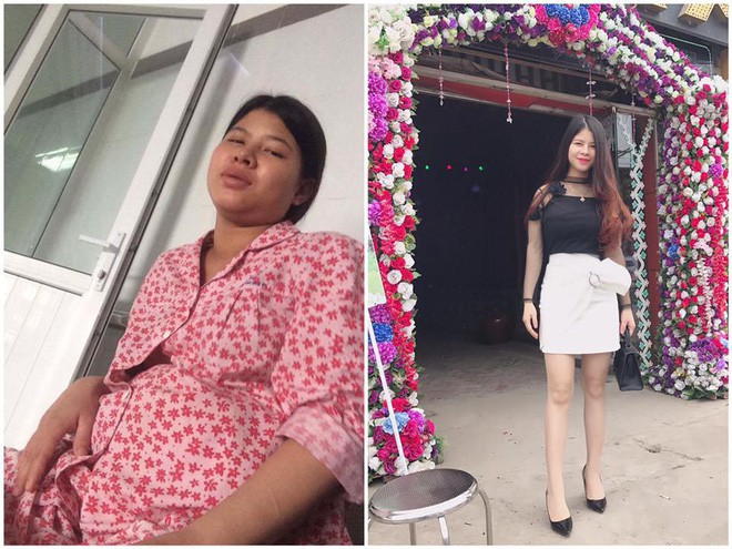 Hội chị em khoe ảnh thay đổi ngoạn mục: Ngày đi đẻ xấu xí bao nhiêu, sinh con xong rạng ngời bấy nhiêu