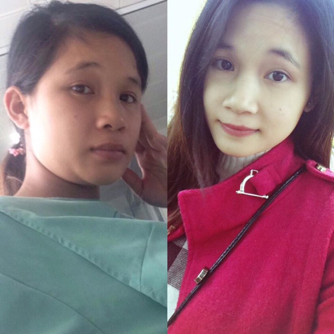 Hội chị em khoe ảnh thay đổi ngoạn mục: Ngày đi đẻ xấu xí bao nhiêu, sinh con xong rạng ngời bấy nhiêu