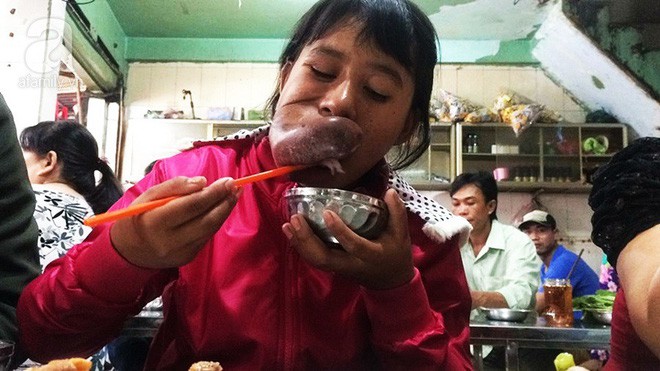 Xót lòng thiếu nữ 15 tuổi mang ngón tay trên miệng, bỏ học vì bạn bè trêu chọc