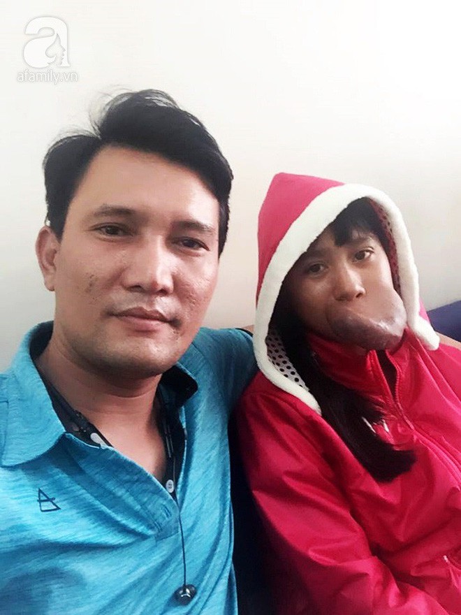 Xót lòng thiếu nữ 15 tuổi mang ngón tay trên miệng, bỏ học vì bạn bè trêu chọc