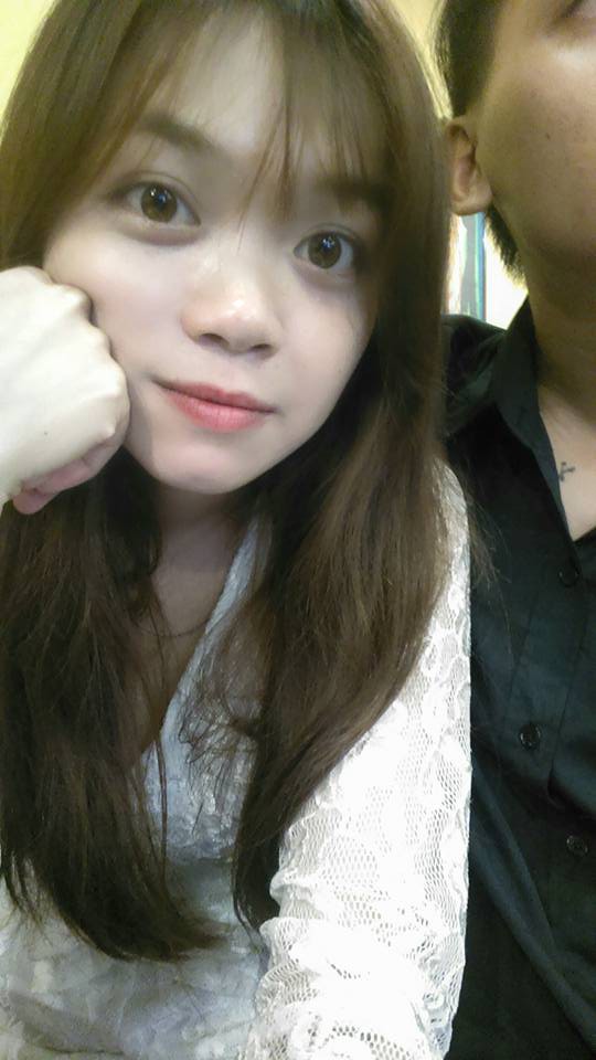 Trải nghiệm kinh hoàng của cô gái trẻ lần đầu nâng mũi sẽ khiến nhiều người nghĩ lại nếu định dao kéo