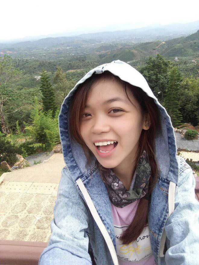 Trải nghiệm kinh hoàng của cô gái trẻ lần đầu nâng mũi sẽ khiến nhiều người nghĩ lại nếu định dao kéo