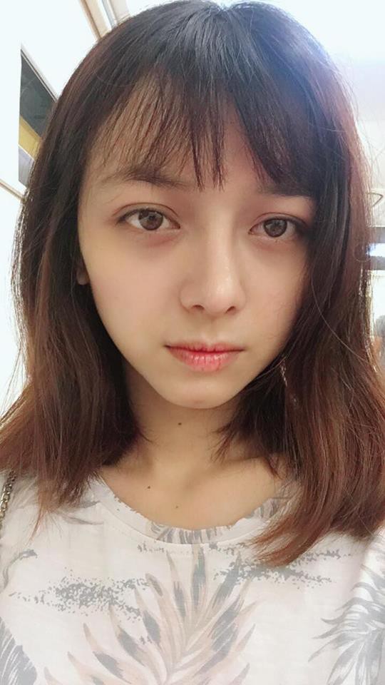 Trải nghiệm kinh hoàng của cô gái trẻ lần đầu nâng mũi sẽ khiến nhiều người nghĩ lại nếu định dao kéo Trải nghiệm kinh hoàng của cô gái trẻ lần đầu nâng mũi sẽ khiến nhiều người nghĩ lại nếu định dao kéo