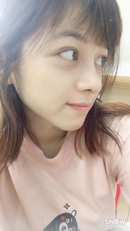 Trải nghiệm kinh hoàng của cô gái trẻ lần đầu nâng mũi sẽ khiến nhiều người nghĩ lại nếu định dao kéo Trải nghiệm kinh hoàng của cô gái trẻ lần đầu nâng mũi sẽ khiến nhiều người nghĩ lại nếu định dao kéo