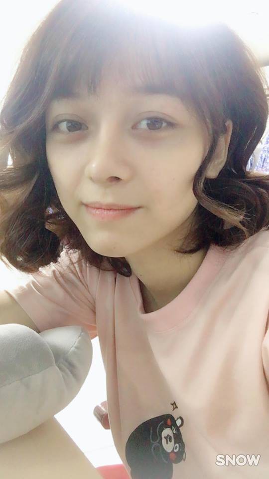 Trải nghiệm kinh hoàng của cô gái trẻ lần đầu nâng mũi sẽ khiến nhiều người nghĩ lại nếu định dao kéo