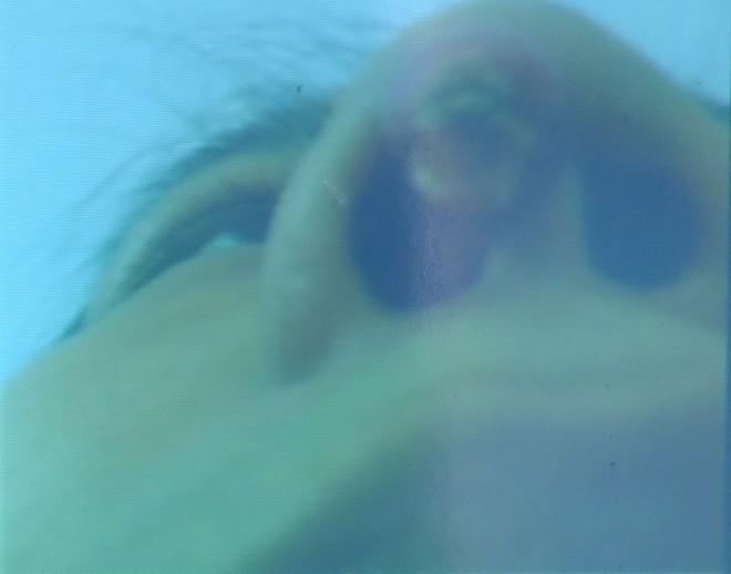 Đua nhau đi làm đẹp đón Tết với giá rẻ, nhiều chị em thủng mũi, biến dạng mí mắt, lõm má