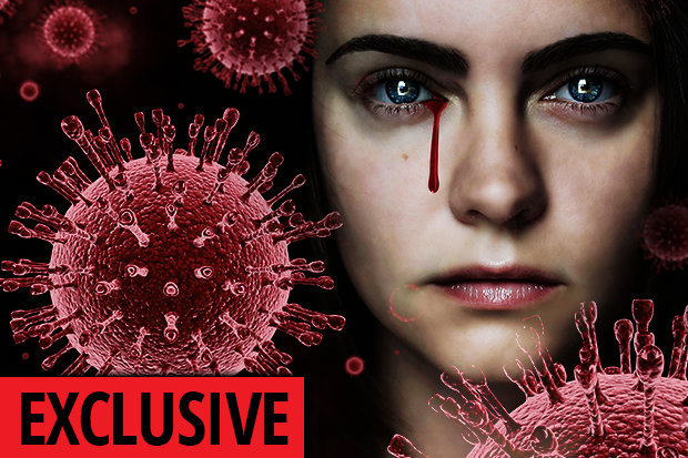 Cảnh báo sốc: Bệnh chảy máu mắt nguy cơ thành đại dịch giống Ebola Cảnh báo sốc: Bệnh chảy máu mắt nguy cơ thành đại dịch giống Ebola